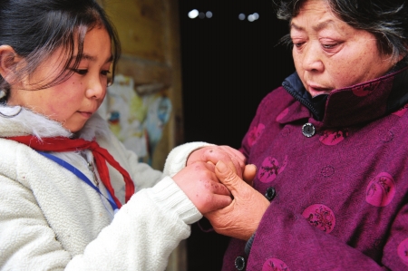 王登玉經(jīng)常做家務(wù),奶奶心疼地?fù)崦䦟O女被凍壞的小手。